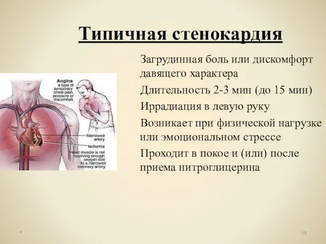 Типичная стенокардия Загрудинная боль или дискомфорт давящего характера Длительность 2-3 мин