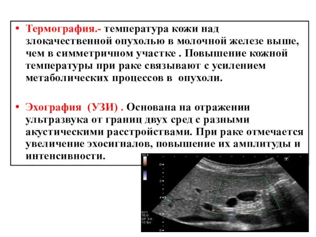 Термография.- температура кожи над злокачественной опухолью в молочной железе выше, чем