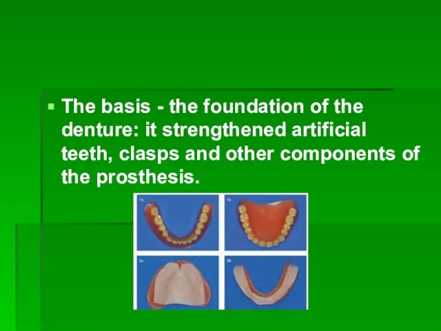 The basis - the foundation of the denture: it strengthened artificial