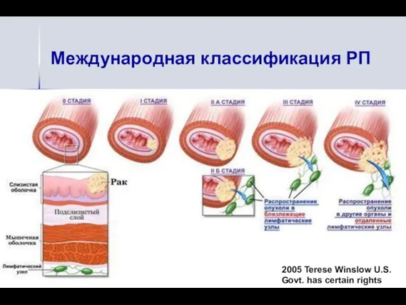 Международная классификация РП 2005 Terese Winslow U.S. Govt. has certain rights