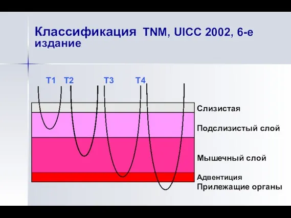 Классификация TNM, UICC 2002, 6-е издание Т1 Т2 Т3 Т4 Слизистая