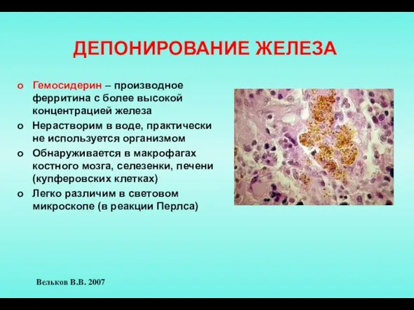 ДЕПОНИРОВАНИЕ ЖЕЛЕЗА Гемосидерин – производное ферритина с более высокой концентрацией железа