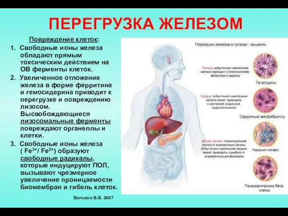 ПЕРЕГРУЗКА ЖЕЛЕЗОМ Повреждение клеток: 1. Свободные ионы железа обладают прямым токсическим