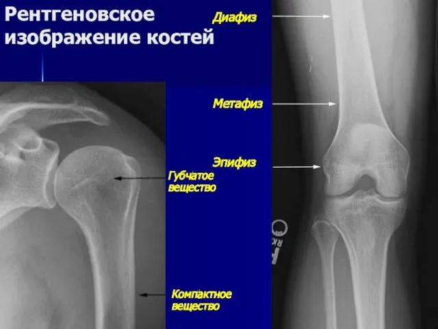 Диафиз Метафиз Эпифиз Рентгеновское изображение костей Компактное вещество Губчатое вещество