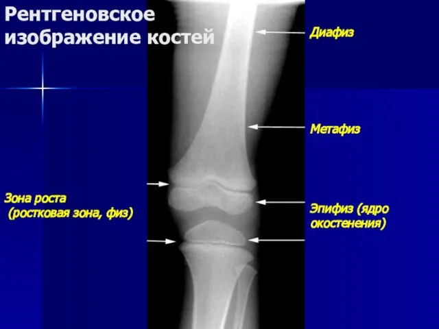 Диафиз Метафиз Эпифиз (ядро окостенения) Зона роста (ростковая зона, физ) Рентгеновское изображение костей