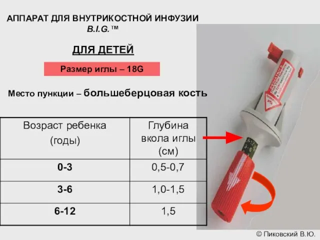 АППАРАТ ДЛЯ ВНУТРИКОСТНОЙ ИНФУЗИИ B.I.G.™ ДЛЯ ДЕТЕЙ Размер иглы – 18G Место пункции – большеберцовая кость