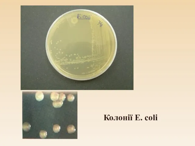 Колонії E. coli