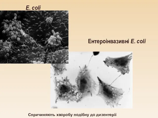 E. coli Ентероінвазивні E. coli Спричиняють хворобу подібну до дизентерії