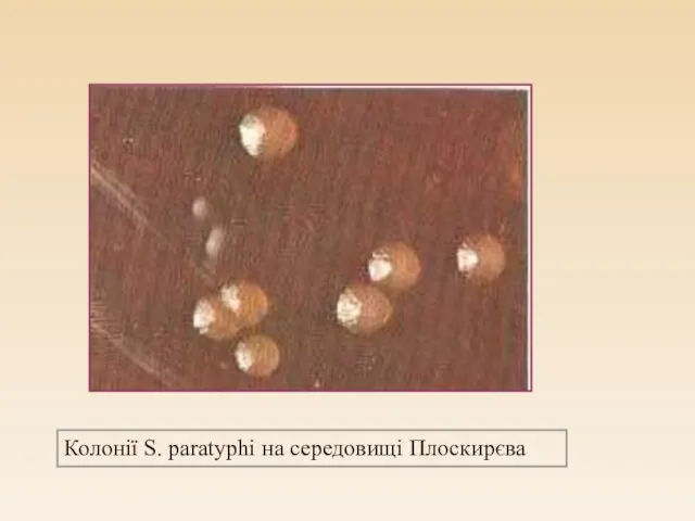 Колонії S. paratyphi на середовищі Плоскирєва