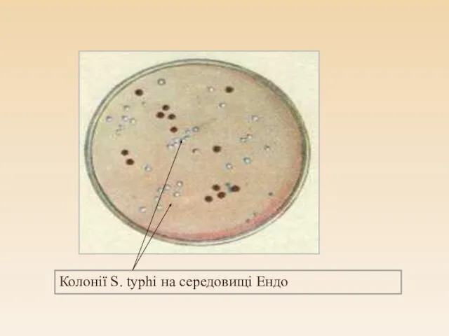 Колонії S. typhi на середовищі Ендо