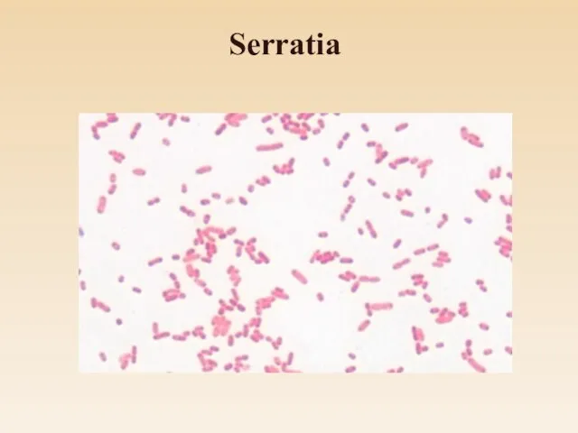 Serratia