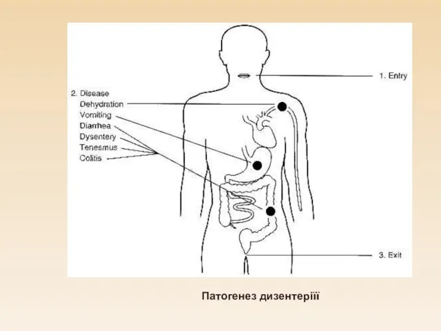 Патогенез дизентеріїї