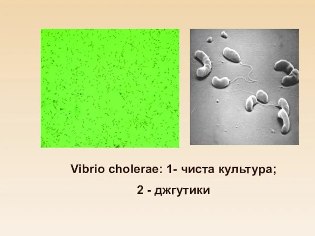 Vibrio cholerae: 1- чиста культура; 2 - джгутики