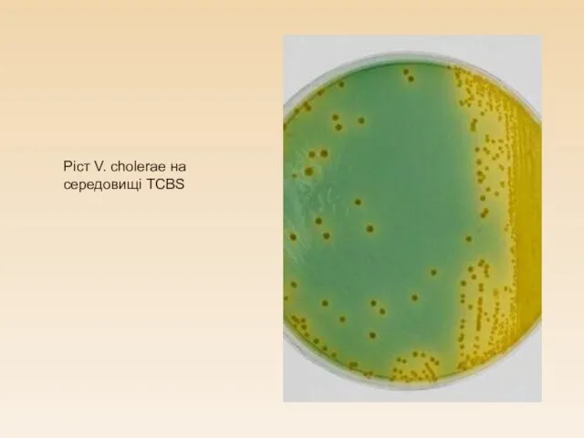 Ріст V. cholerae на середовищі TCBS