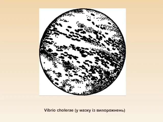 Vibrio cholerae (у мазку із випорожнень)