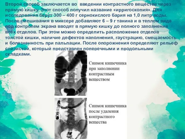 Второй способ заключается во введении контрастного вещества через прямую кишку. Этот