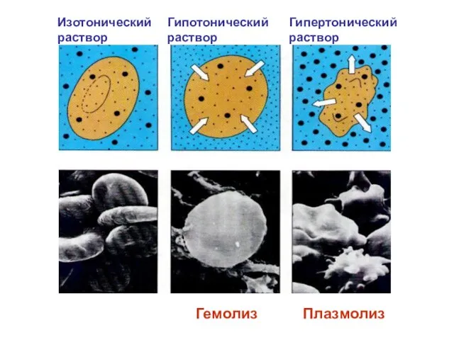 Гемолиз Плазмолиз Изотонический раствор Гипотонический раствор Гипертонический раствор