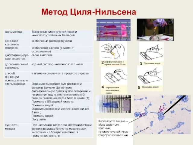 Метод Циля-Нильсена Кислотоустойчивые – Mycobacterium-красные; некислотоустойчивые – Staphylococcus-синие