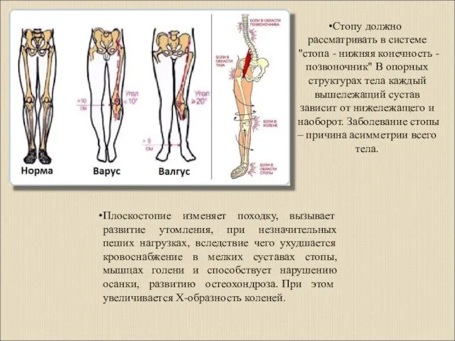 Стопу должно рассматривать в системе "стопа - нижняя конечность - позвоночник"