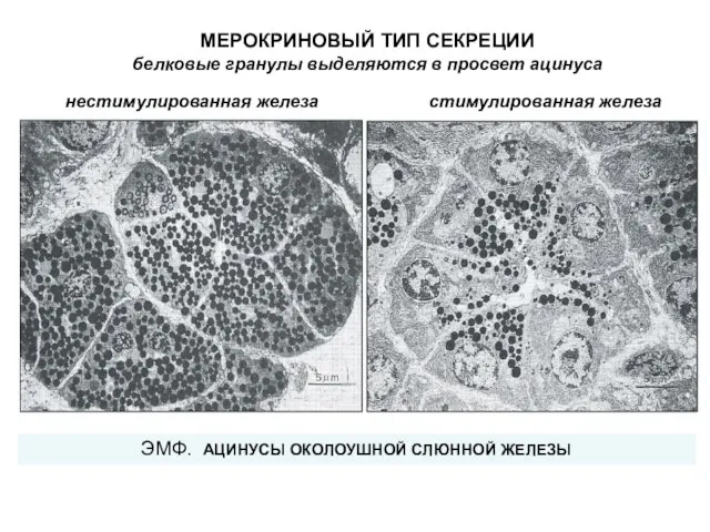 ЭМФ. АЦИНУСЫ ОКОЛОУШНОЙ СЛЮННОЙ ЖЕЛЕЗЫ нестимулированная железа стимулированная железа МЕРОКРИНОВЫЙ ТИП