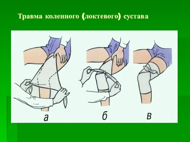 Травма коленного (локтевого) сустава