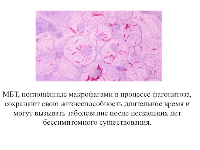 МБТ, поглощённые макрофагами в процессе фагоцитоза, сохраняют свою жизнеспособность длительное время