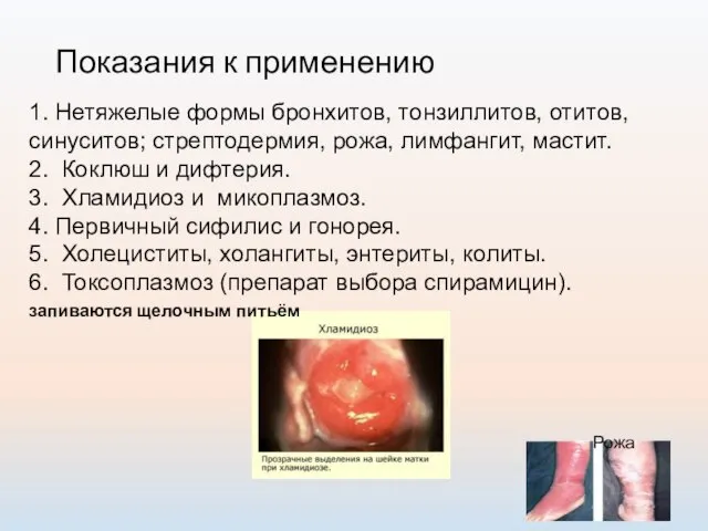 Показания к применению 1. Нетяжелые формы бронхитов, тонзиллитов, отитов, синуситов; стрептодермия,