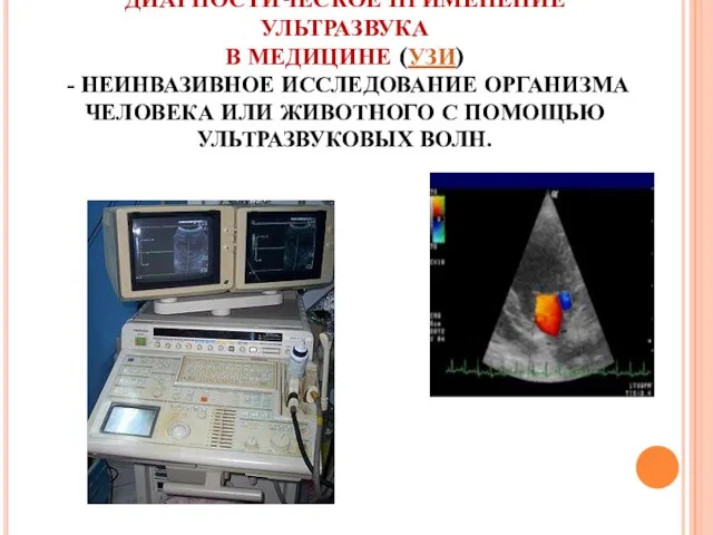 ДИАГНОСТИЧЕСКОЕ ПРИМЕНЕНИЕ УЛЬТРАЗВУКА В МЕДИЦИНЕ (УЗИ) - НЕИНВАЗИВНОЕ ИССЛЕДОВАНИЕ ОРГАНИЗМА ЧЕЛОВЕКА