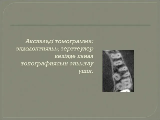 Аксиальді томограмма: эндодонтиялық зерттеулер кезінде канал топографиясын анықтау үшін.