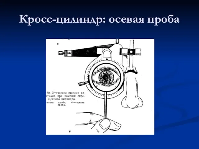 Кросс-цилиндр: осевая проба