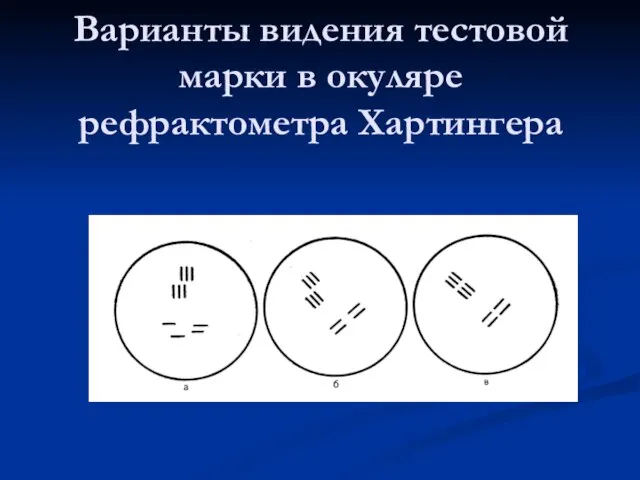 Варианты видения тестовой марки в окуляре рефрактометра Хартингера