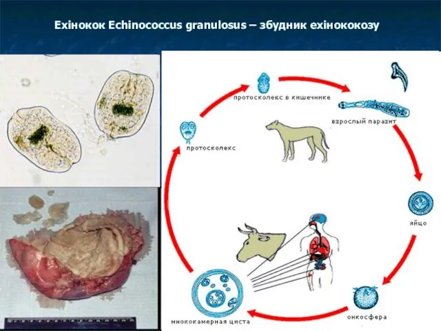 Ехінокок Echinococcus granulosus – збудник ехінококозу