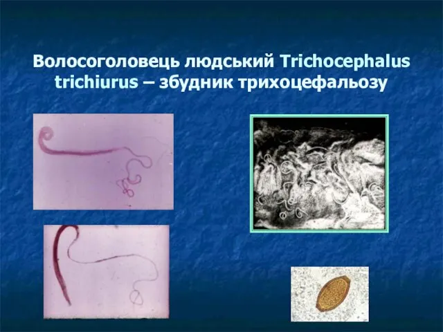 Волосоголовець людський Trichocephalus trichiurus – збудник трихоцефальозу