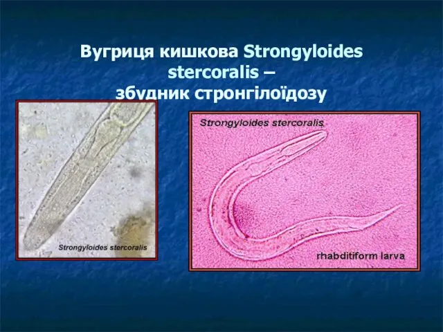 Вугриця кишкова Strongyloides stercoralis – збудник стронгілоїдозу