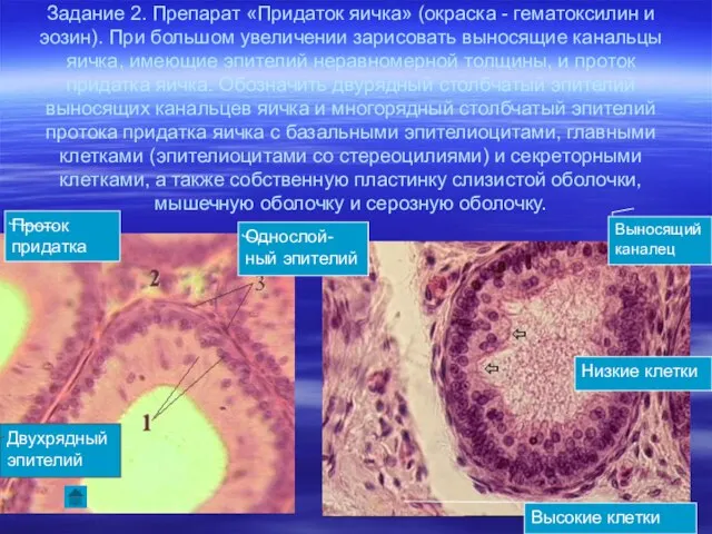 Задание 2. Препарат «Придаток яичка» (окраска - гематоксилин и эозин). При