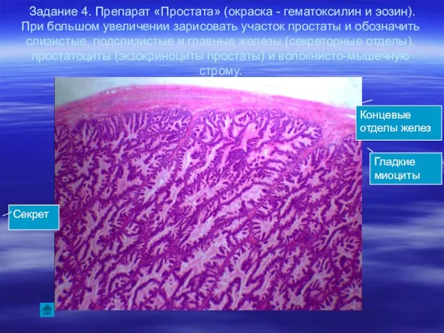 Задание 4. Препарат «Простата» (окраска - гематоксилин и эозин). При большом