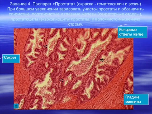 Задание 4. Препарат «Простата» (окраска - гематоксилин и эозин). При большом