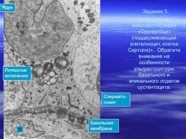 Задание 5. Электронная микрофотография «Сустентоцит (поддерживающий эпителиоцит, клетка Сертоли)». Обратите внимание