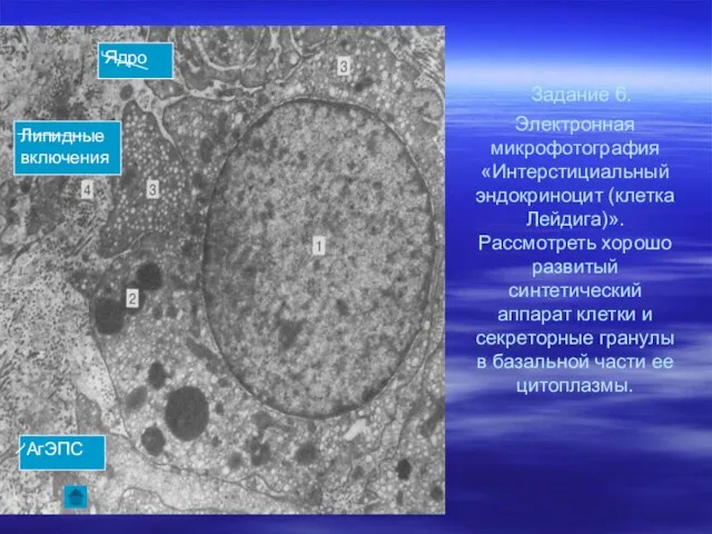 Задание 6. Электронная микрофотография «Интерстициальный эндокриноцит (клетка Лейдига)». Рассмотреть хорошо развитый