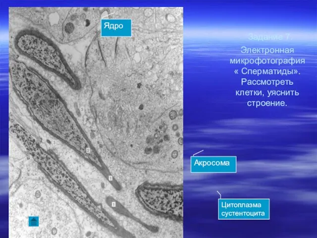 Задание 7. Электронная микрофотография « Сперматиды». Рассмотреть клетки, уяснить строение. Акросома Цитоплазма сустентоцита Ядро