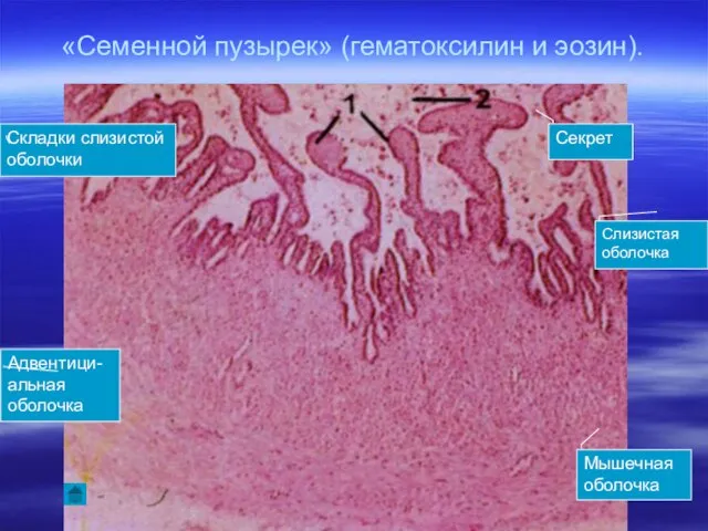 «Семенной пузырек» (гематоксилин и эозин). Секрет Адвентици-альная оболочка Мышечная оболочка Слизистая оболочка Складки слизистой оболочки