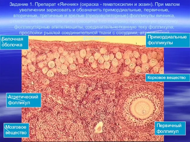 Задание 1. Препарат «Яичник» (окраска - гематоксилин и эозин). При малом