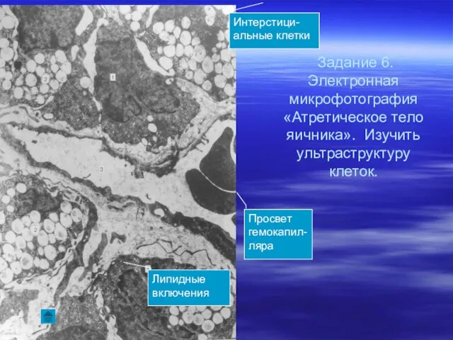 Задание 6. Электронная микрофотография «Атретическое тело яичника». Изучить ультраструктуру клеток. Просвет гемокапил-ляра Липидные включения Интерстици-альные клетки