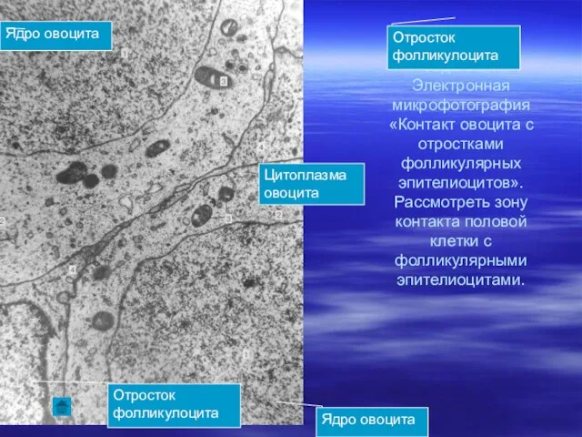 Задание 7. Электронная микрофотография «Контакт овоцита с отростками фолликулярных эпителиоцитов». Рассмотреть