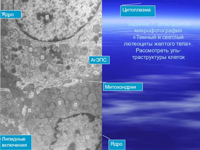Задание 7. Электронная микрофотография «Темный и светлый лютеоциты желтого тела». Рассмотреть