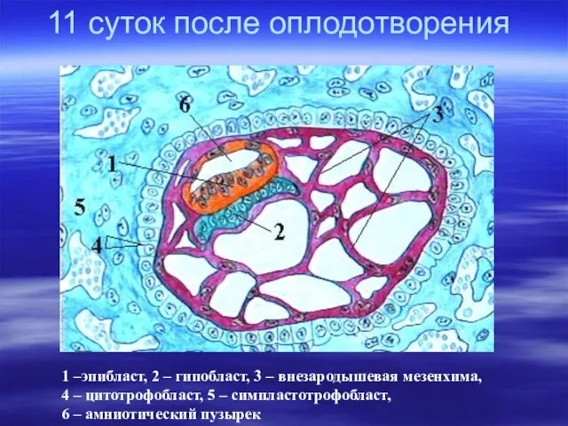 11 суток после оплодотворения 1 –эпибласт, 2 – гипобласт, 3 –