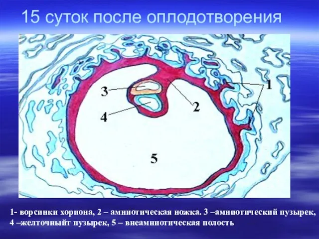 15 суток после оплодотворения 1- ворсинки хориона, 2 – амниотическая ножка.