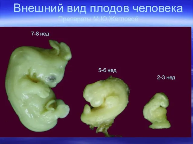 Внешний вид плодов человека Препараты М.Ю.Жегловой 2-3 нед 5-6 нед 7-8 нед