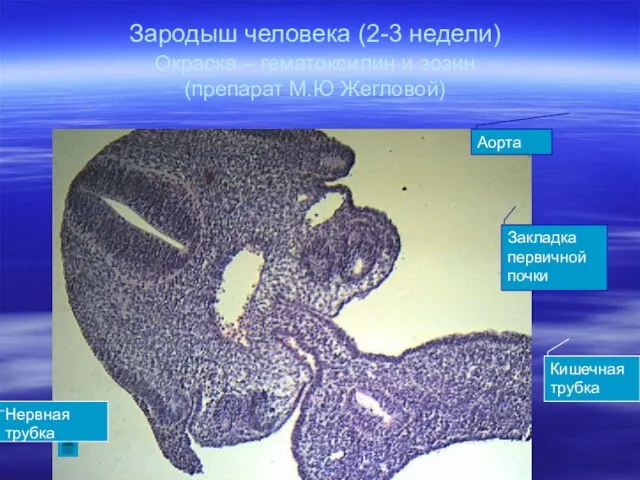 Зародыш человека (2-3 недели) Окраска – гематоксилин и эозин (препарат М.Ю