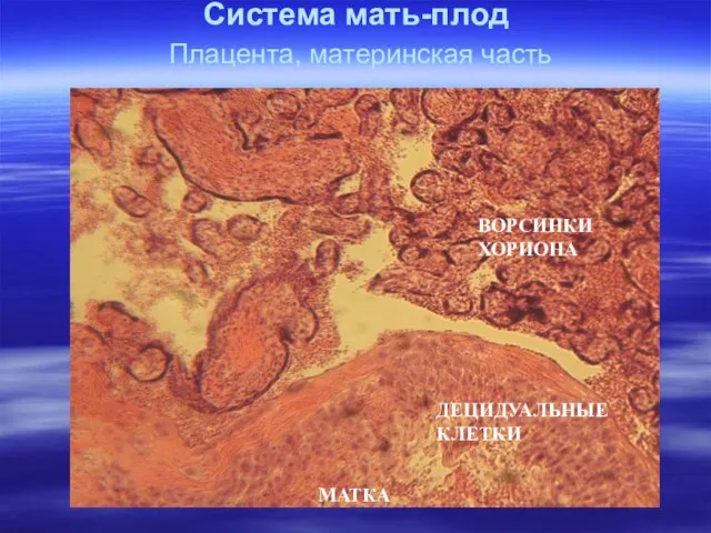 Система мать-плод Плацента, материнская часть МАТКА ВОРСИНКИ ХОРИОНА ДЕЦИДУАЛЬНЫЕ КЛЕТКИ